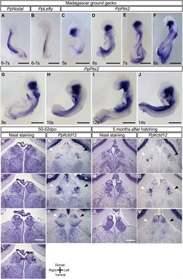 Left-right asymmetric expression of the Nodal-Lefty-Pitx2 module in developing turtle forebrain